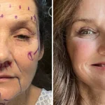 Decizia curajoasă a fiicei lui Loretta Lynn: Turismul medical în Mexic ca soluție pentru un facelift